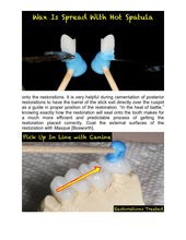 Load image into Gallery viewer, Precision Restoration Seaters. 100 Units