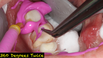 Strupp/Brumm Technique Manual (Flash Drive)