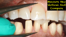 Load image into Gallery viewer, ALL NEW!! Simplifying Complex Entire Lecture, Technique Manual, and Painless Injection Technique. PDF on USB Flash Drive