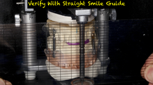 Load image into Gallery viewer, Straight Smile Guide (2 Included for dentist and laboratory)
