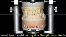 Load image into Gallery viewer, Straight Smile Guide (2 Included for dentist and laboratory)