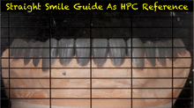 Load image into Gallery viewer, Straight Smile Guide (2 Included for dentist and laboratory)