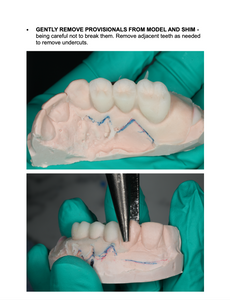 Indirect Provisionals
