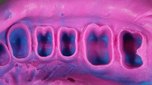 Load image into Gallery viewer, ALL NEW!! Simplifying Complex Entire Lecture, Technique Manual, and Painless Injection Technique. PDF on USB Flash Drive